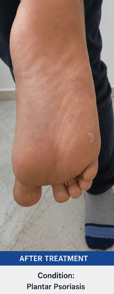 After treatment