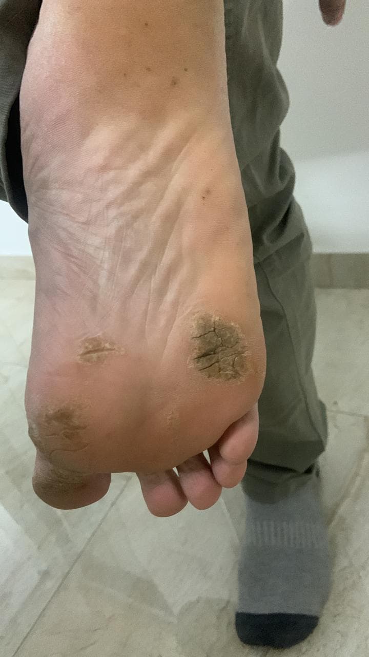 Before treatment