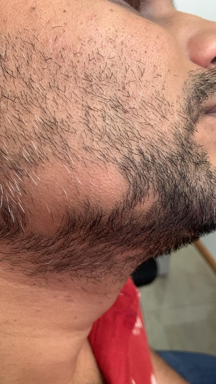 Before treatment